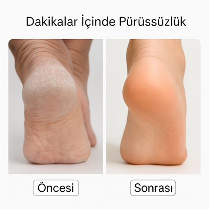 Nuvates Pro - Şarjlı Ayak Törpü Cihazı